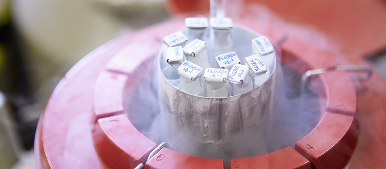 Pembekuan Sperma (Sperm Freezing)