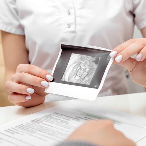Apa Itu Ovum? Fungsi, Struktur, Penyakit, dan Pengobatan