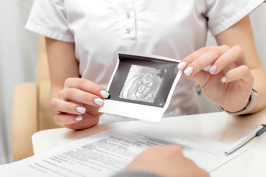 Apa Itu Ovum? Fungsi, Struktur, Penyakit, dan Pengobatan