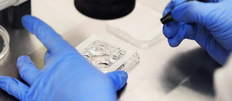 Pemeriksaan Tes Kesuburan Pria dan Wanita
