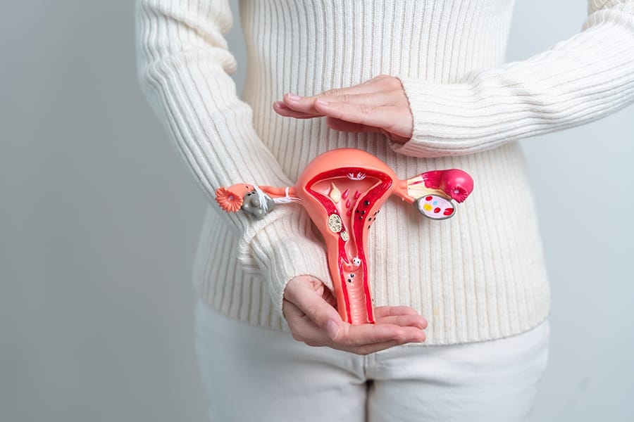 Mioma Geburt, Gangguan Reproduksi Wanita yang Menyebabkan Anemia