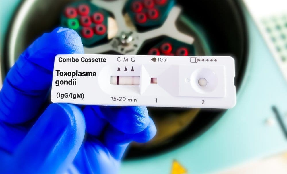 Toxoplasma Adalah Gejala, Penyebab, dan Cara Mencegah Infeksi Parasit