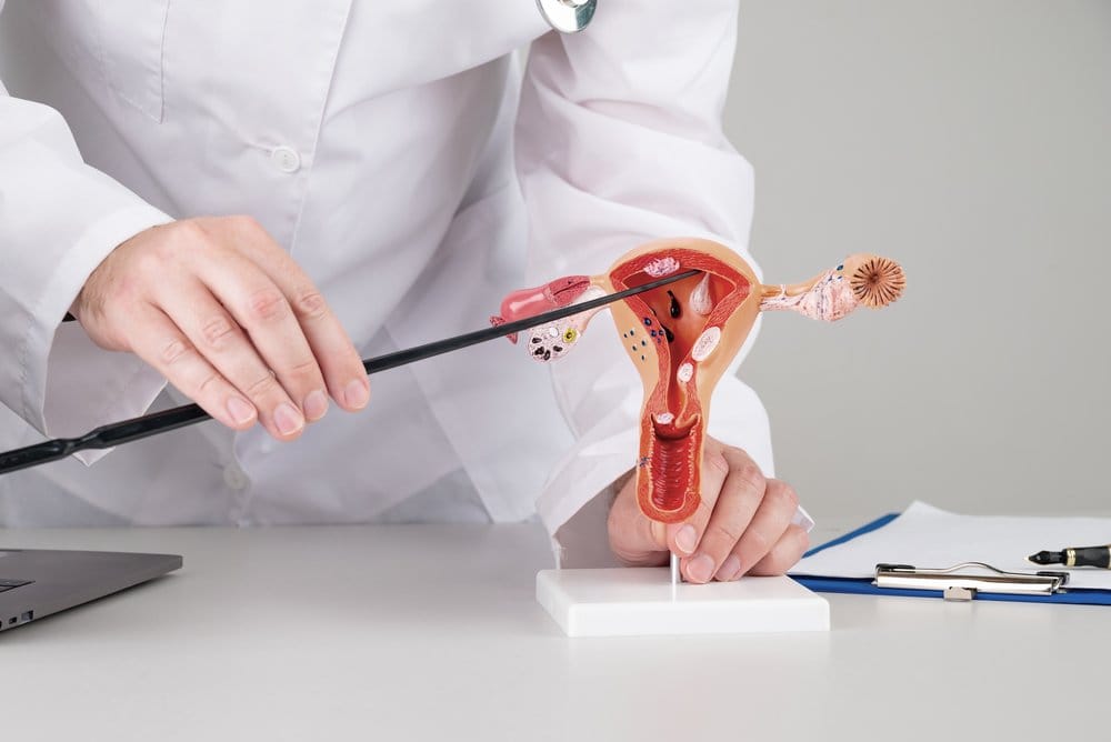 5 Perbedaan PCO dan PCOS, Jangan Sampai Keliru!
