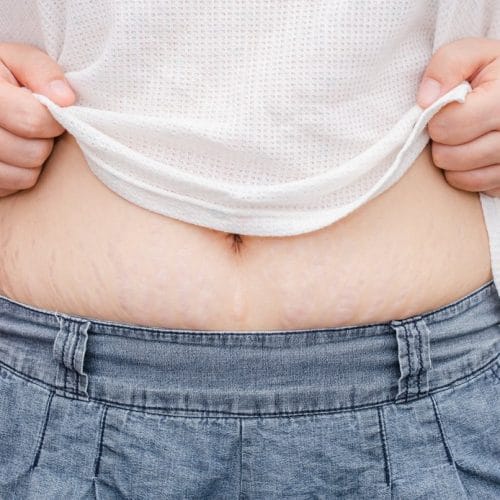 7 Ciri-Ciri Fisik Orang Hamil yang Umum hingga Jarang Disadari