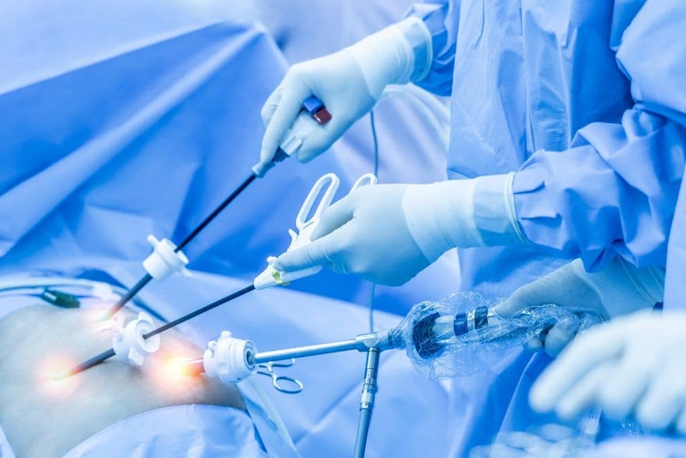Prosedur Laparoskopi untuk Program Hamil dan Manfaatnya