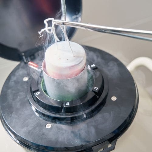 Cek Kelebihan & Kekurangan Pembekuan Sel Telur (Egg Freezing)