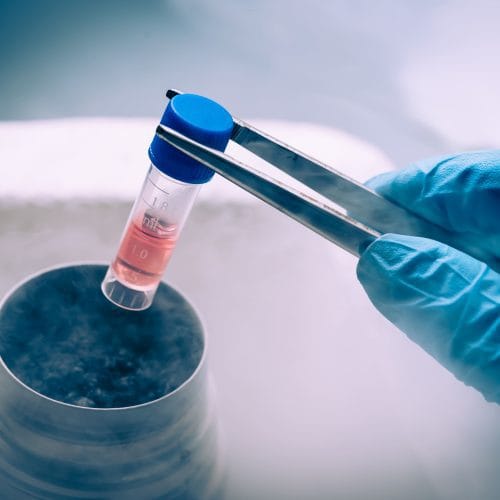 Apa Tujuan Pembekuan Sel Telur (Egg Freezing) untuk Wanita?