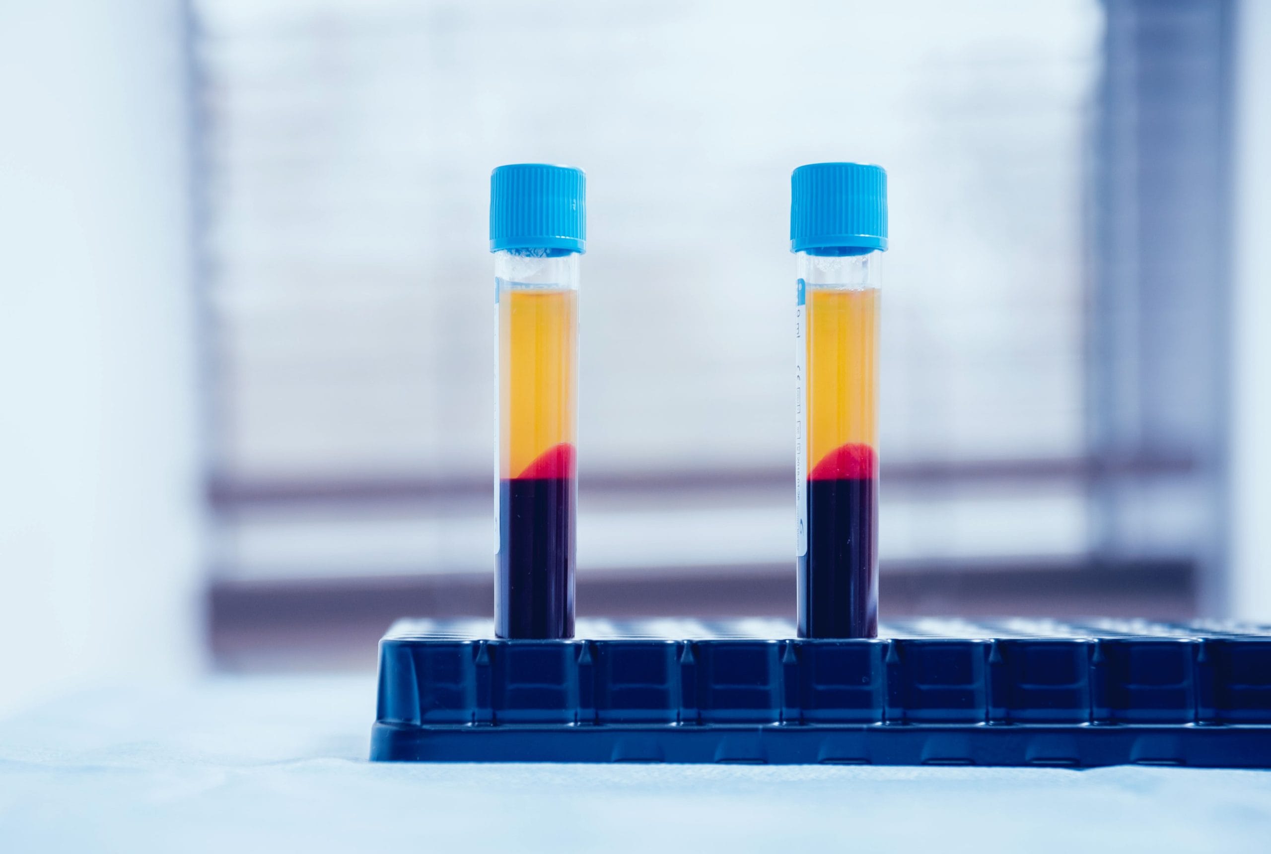Platelets Rich Plasma Ovarium: Prosedur, Manfaat, dan Efektivitas