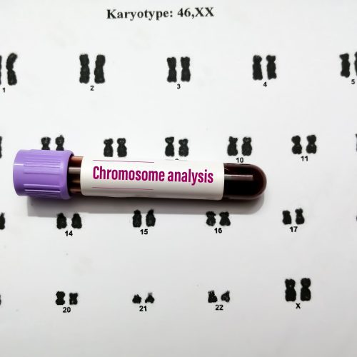 Mengenal Tes Karyotyping untuk Medekteksi Kelainan Genetik