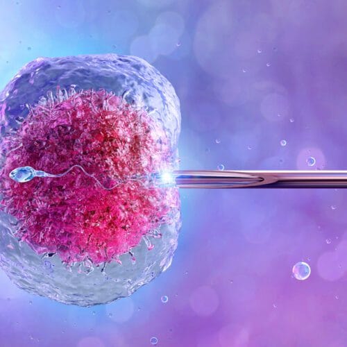 Tujuan Inseminasi Buatan (IUI) dalam Program Hamil