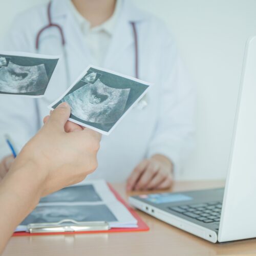 Estimasi Biaya Bayi Tabung Ciputra IVF 2026