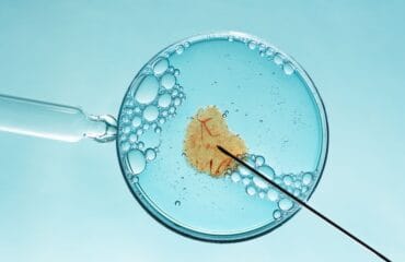 Inilah Kisaran Biaya Inseminasi Buatan
