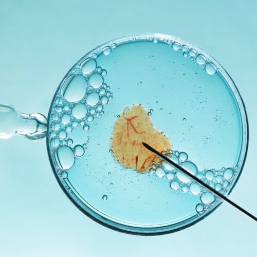 Inilah Kisaran Biaya Inseminasi Buatan