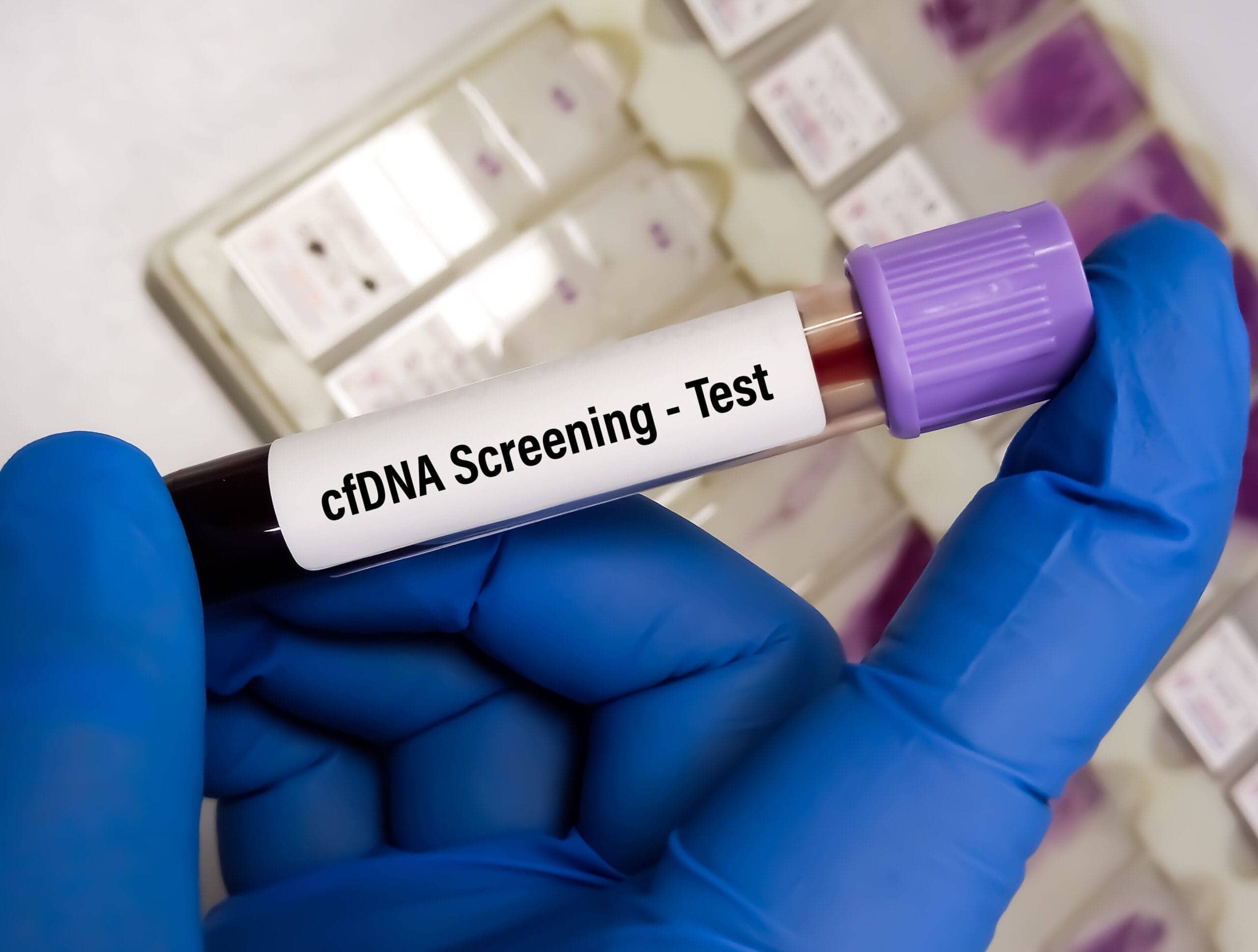 Tes Prenatal Cell-Free DNA (cfDNA) dan Prosedurnya