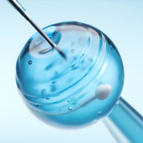 Daftar FAQ Inseminasi Buatan (IUI) yang Penting Diketahui