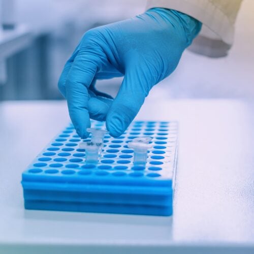 PGT-M (Preimplantation Genetic Testing) Program Bayi Tabung