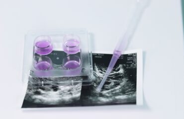 Program Bayi Tabung untuk Penderita PCOS: Tingkat Keberhasilan dan Prosedurnya