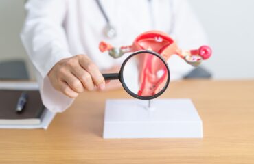 Kista vs PCOS vs Endometrioma: Perbedaan dan Cara Mengenalinya