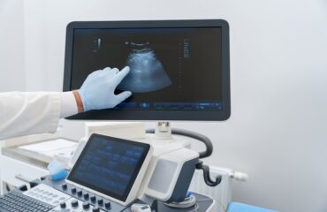 Endometriosis vs Adenomiosis vs Mioma: Mengenali Perbedaannya