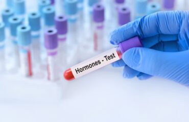 Cara Mendiagnosis PCOS: Tes USG, Hormon, dan Kriteria Rotterdam