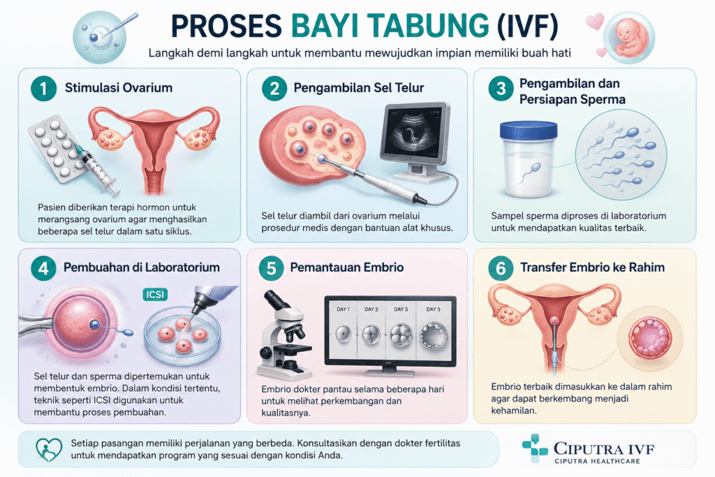 Infografis 6 tahapan proses bayi tabung (IVF): stimulasi ovarium hingga transfer embrio