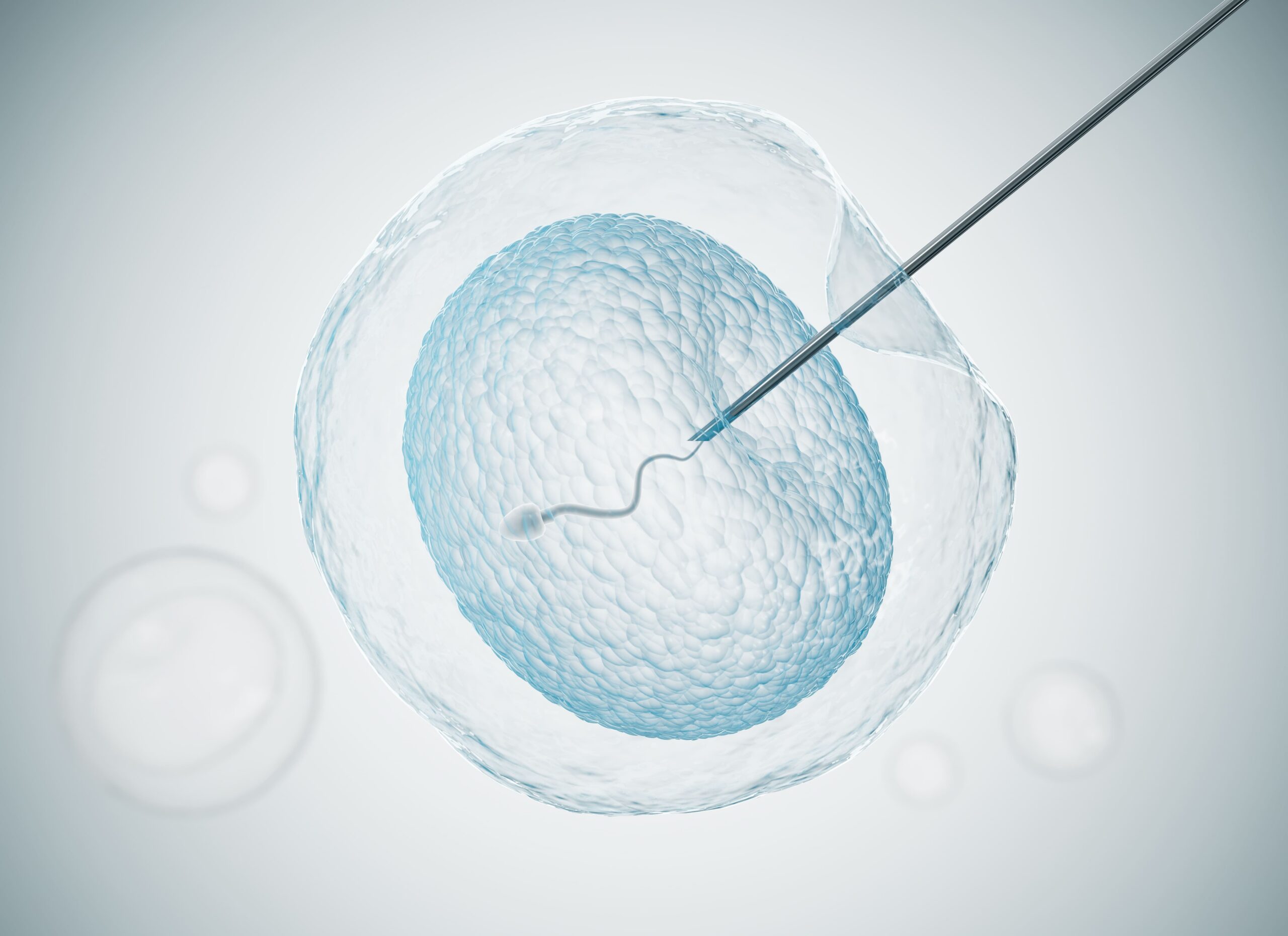round spermatid injection